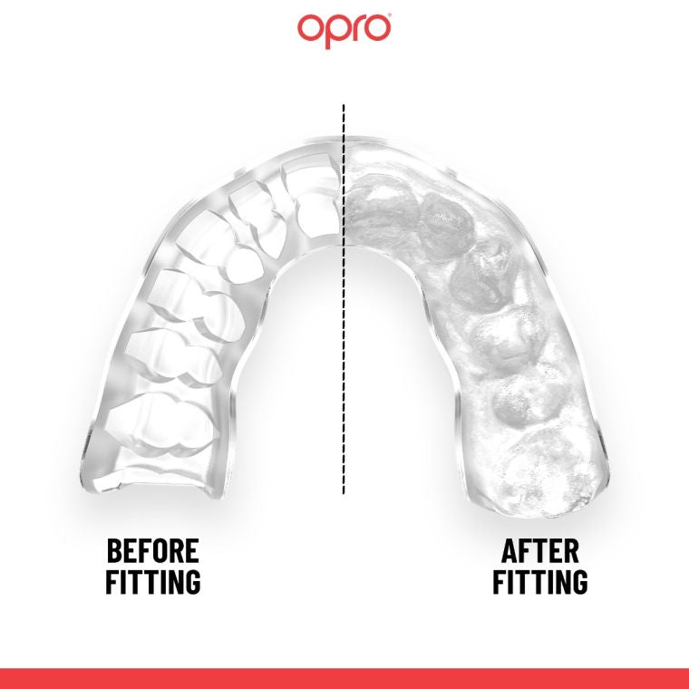 Opro Mouth Guard Czech Republic Instant Custom Fit